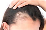 Follicl MD - Hair transplant - Greffe de cheveux