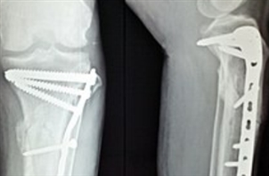 Dr. Behrooz Akbarnia