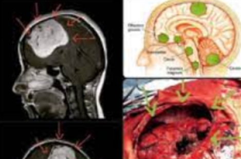 Dr. Payman Sadeghi, MD