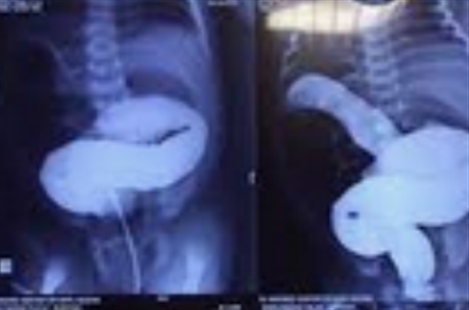 Dr Arman Khorasani-Zadeh