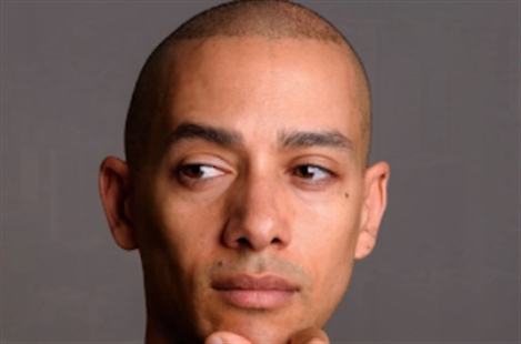 Hair Transplant Toronto