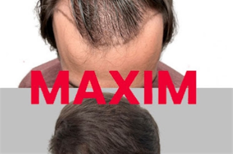 MAXIM Hair Restoration & Transplants - New York City