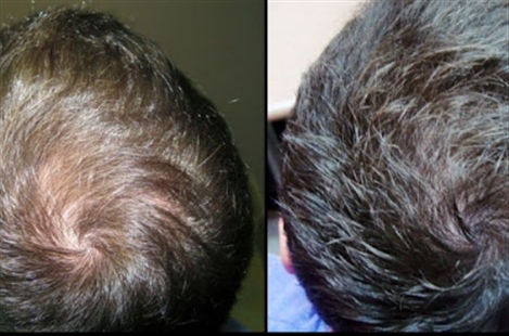 Sure Hair International