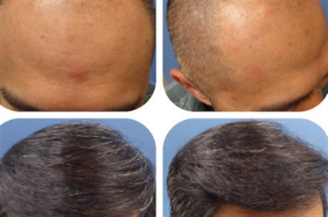 Meshkin Medical - Cosmetic Hair Restoration and Hair Transplant Clinic