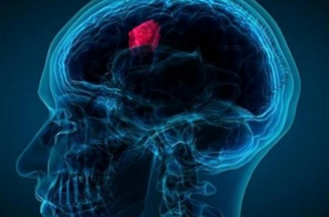 Dr. Daryoush Tavanaiepour