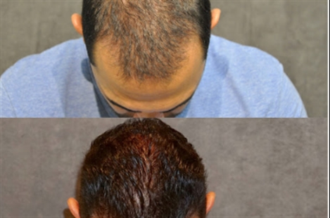 Beverly Hills Hair Group