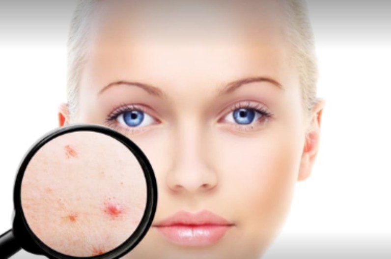 Avin Skin Care Clinic