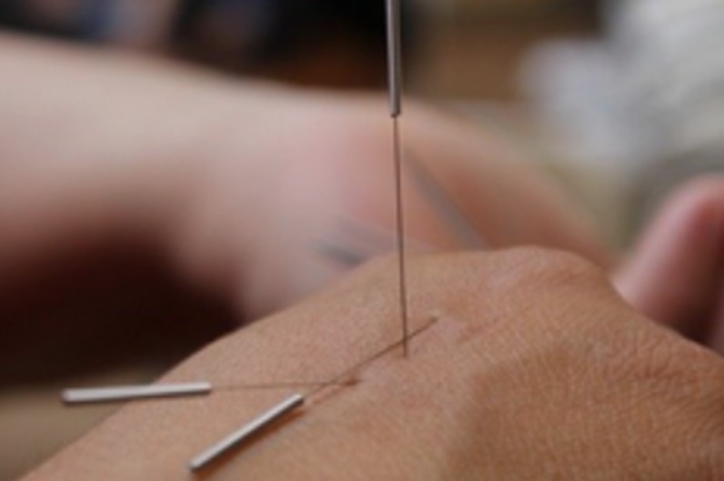 True Wellness Acupuncture Clinic